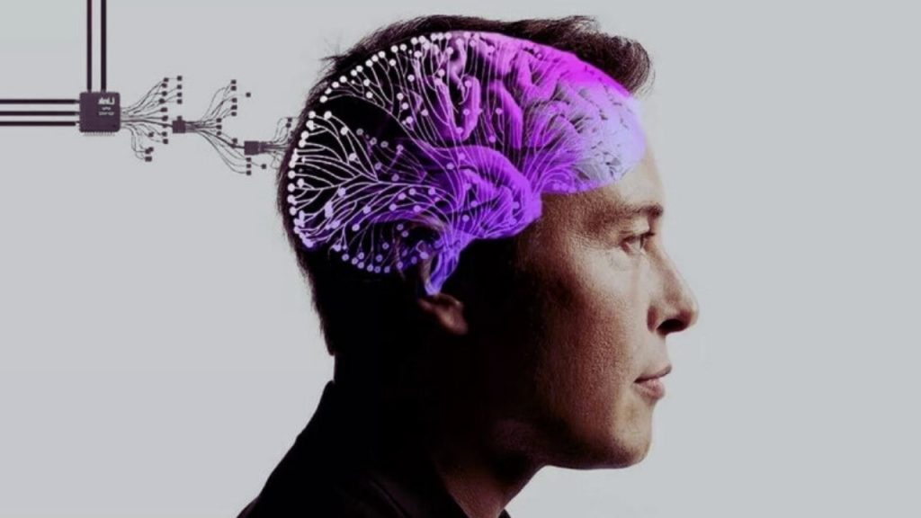 Neuralink Beyin Çipi